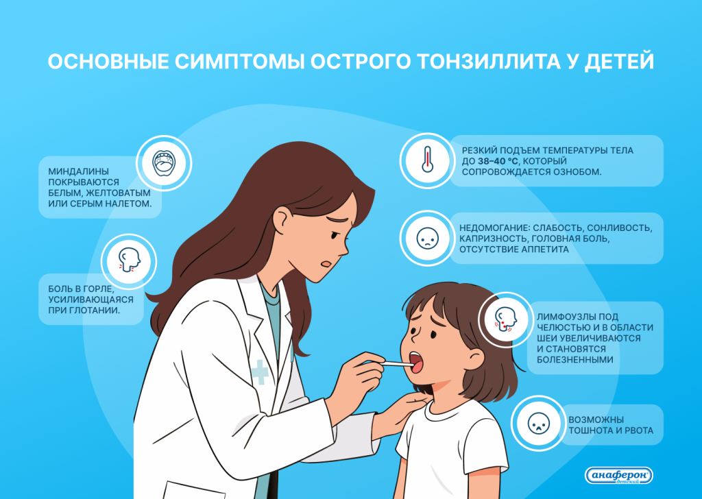 Симптомы острого тонзиллита у детей.png